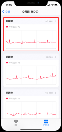 心電図の波形をタップする