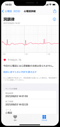 Apple Watchで記録した心電図の波形や結果などを確認する