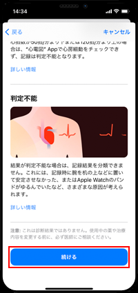Apple Watchの心電図の記録の判定を確認する