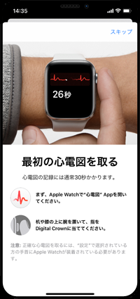 Apple Watchで心電図を記録する