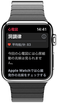 Apple Watchで心電図の記録を完了する